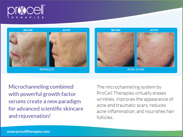 ProCell Microneedling